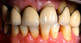 Zahnarzt Bochum Parodontologie
